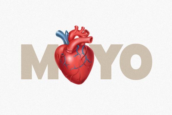 Moyo audio by Diamond Platnumz